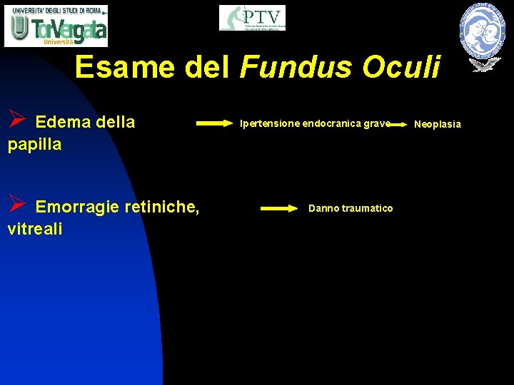 Esame del Fundus Oculi Ø Edema della Ipertensione endocranica grave papilla Ø Emorragie retiniche,