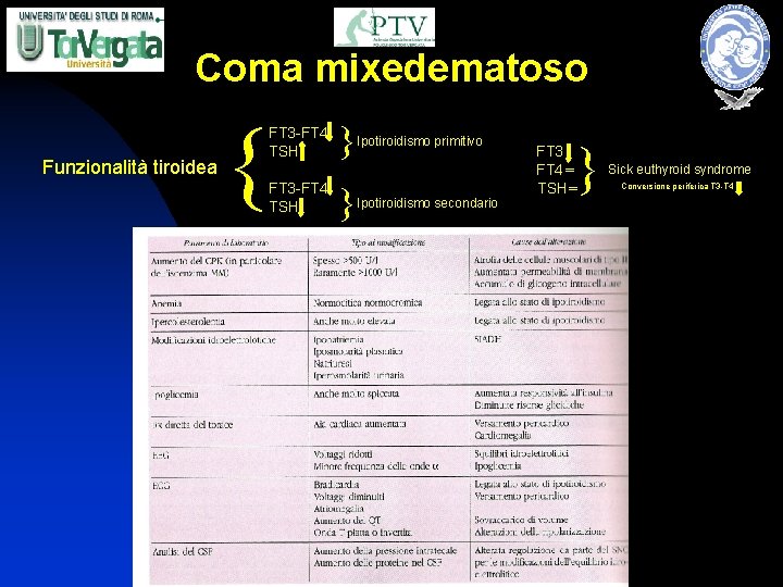 Coma mixedematoso { FT 3 -FT 4 TSH Ipotiroidismo primitivo Ipotiroidismo secondario FT 3