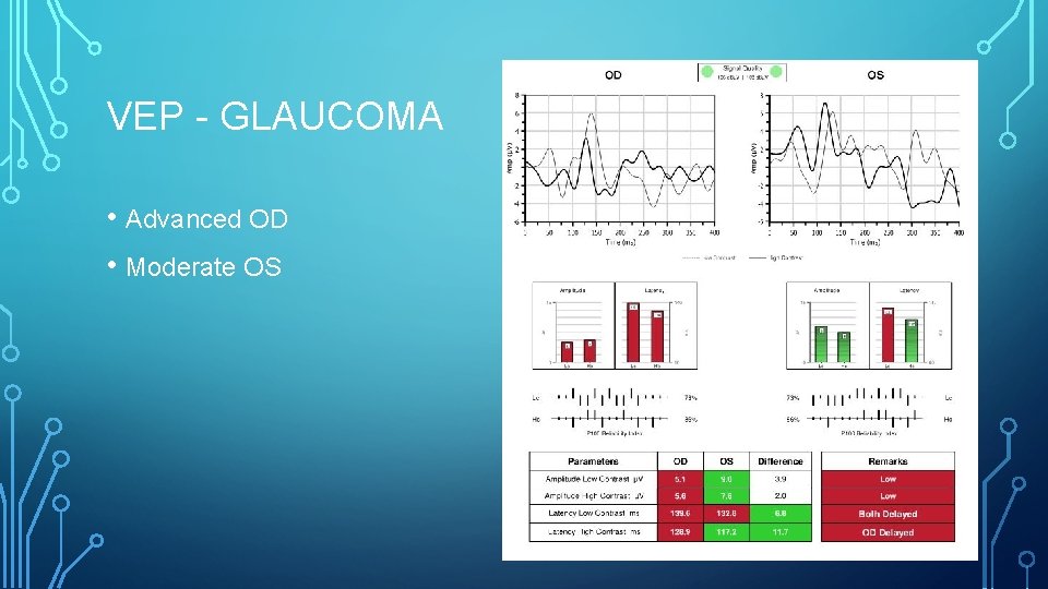 VEP - GLAUCOMA • Advanced OD • Moderate OS 