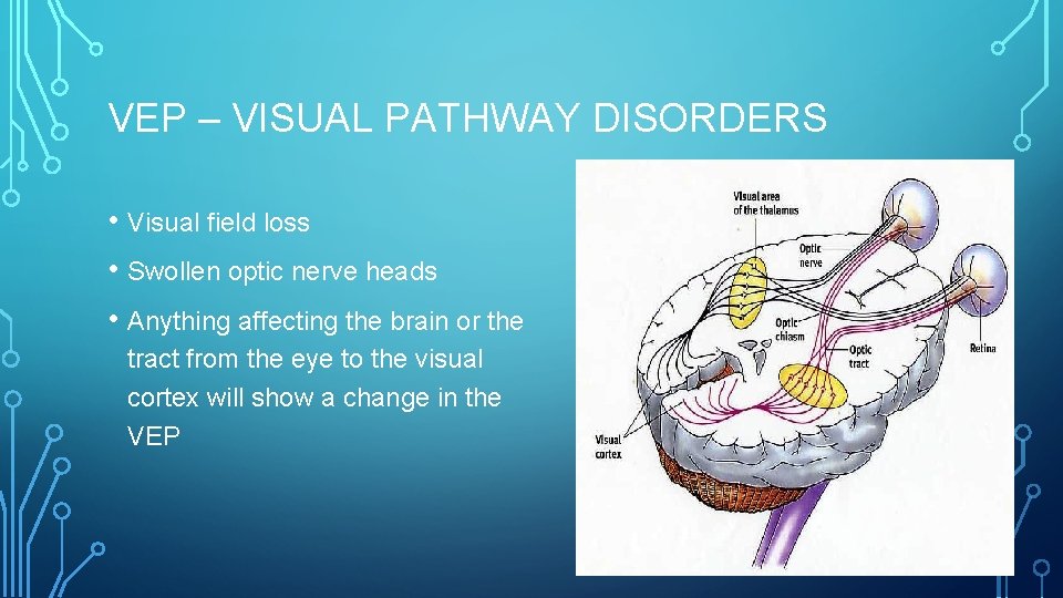 VEP – VISUAL PATHWAY DISORDERS • Visual field loss • Swollen optic nerve heads