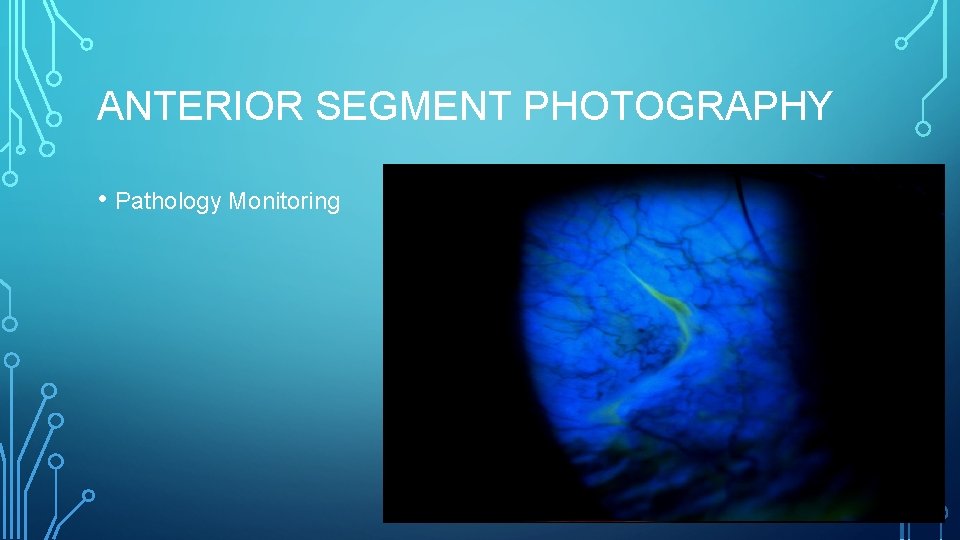 ANTERIOR SEGMENT PHOTOGRAPHY • Pathology Monitoring 
