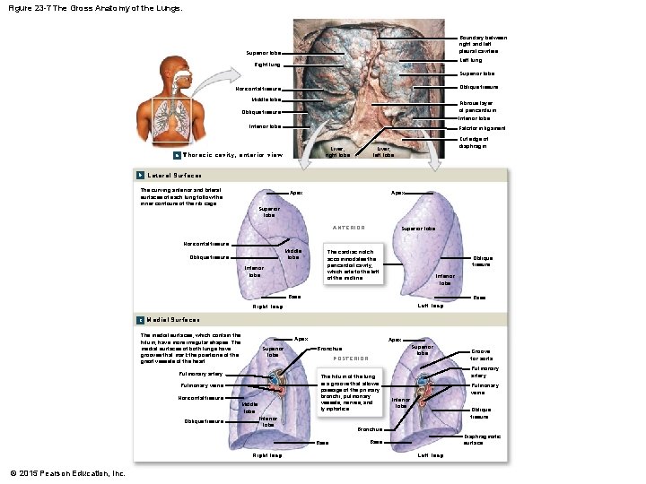 Figure 23 -7 The Gross Anatomy of the Lungs. Boundary between right and left