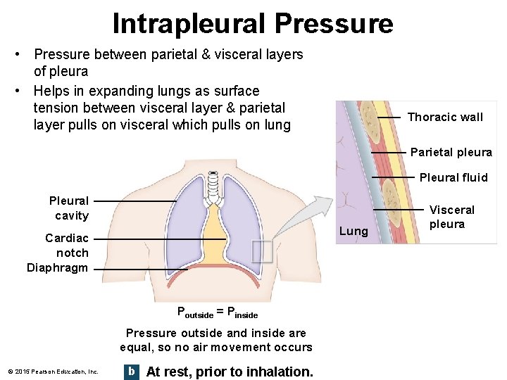 Intrapleural Pressure • Pressure between parietal & visceral layers of pleura • Helps in
