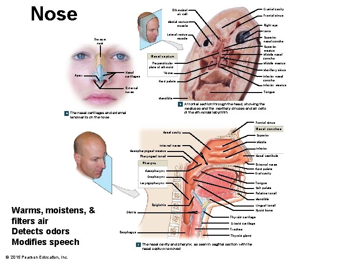 Nose Cranial cavity Ethmoidal air cell Frontal sinus Medial rectus muscle Right eye Lens