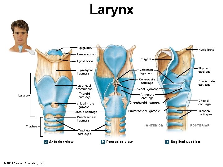 Larynx Epiglottis Hyoid bone Lesser cornu Epiglottis Hyoid bone Vestibular ligament Thyrohyoid ligament Larynx