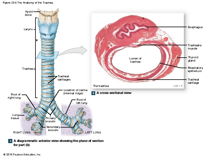 Figure 23 -6 The Anatomy of the Trachea. Hyoid bone Esophagus Larynx Trachealis muscle