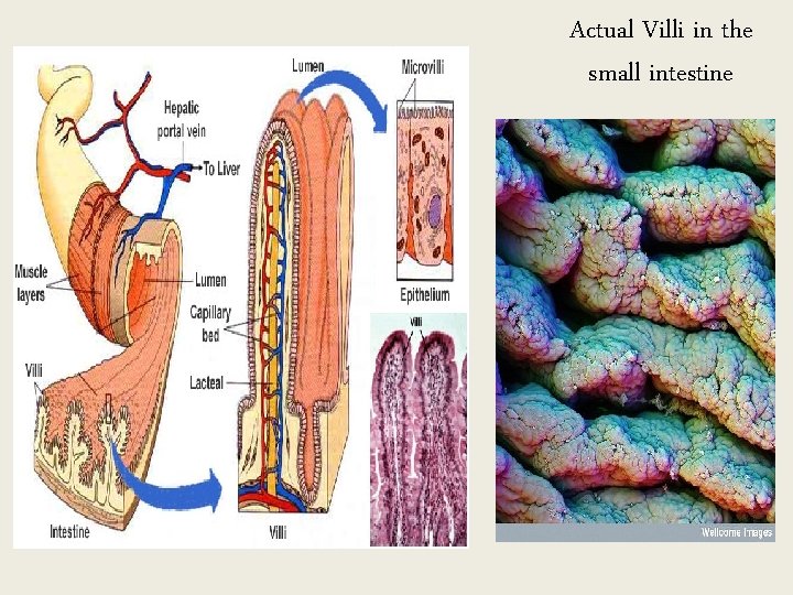 Actual Villi in the small intestine 