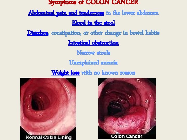 Symptoms of COLON CANCER Abdominal pain and tenderness in the lower abdomen Blood in