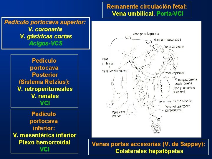 Remanente circulación fetal: Vena umbilical. Porta-VCI Pedículo portocava superior: V. coronaria V. gástricas cortas