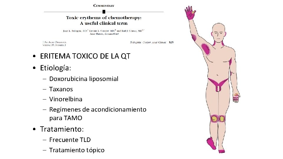  • ERITEMA TOXICO DE LA QT • Etiología: – – Doxorubicina liposomial Taxanos