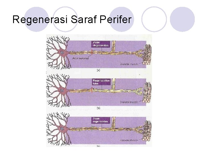 Regenerasi Saraf Perifer 