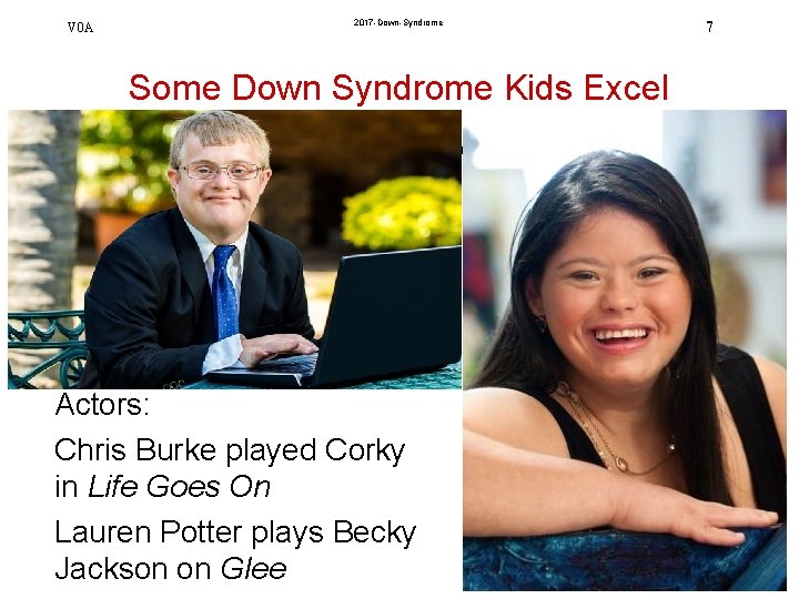 V 0 A 2017 -Down-Syndrome Some Down Syndrome Kids Excel Actors: Chris Burke played