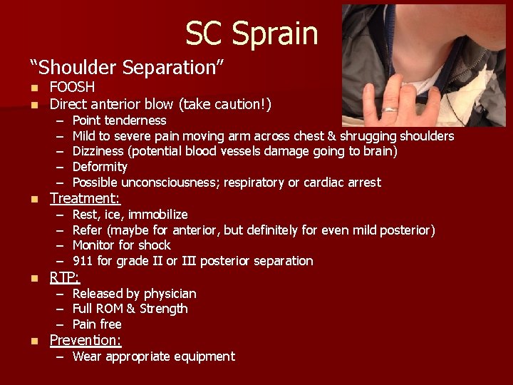 SC Sprain “Shoulder Separation” n n FOOSH Direct anterior blow (take caution!) n Treatment: