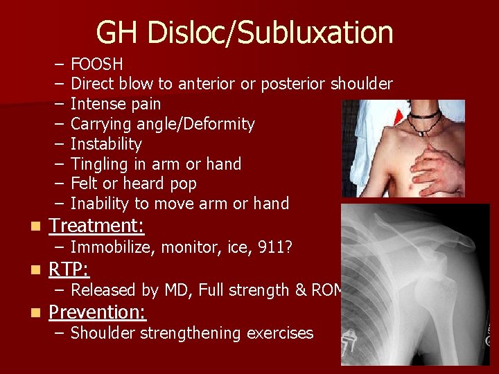 GH Disloc/Subluxation – – – – FOOSH Direct blow to anterior or posterior shoulder