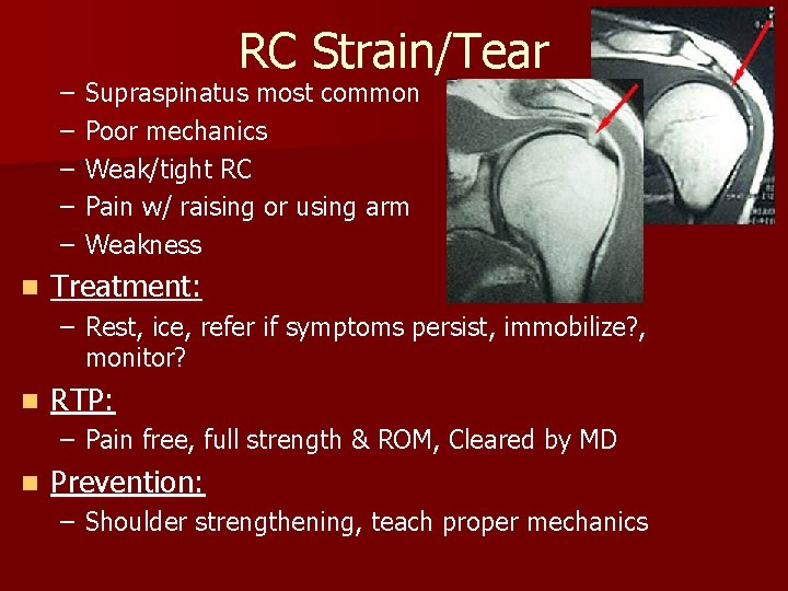 – – – n RC Strain/Tear Supraspinatus most common Poor mechanics Weak/tight RC Pain