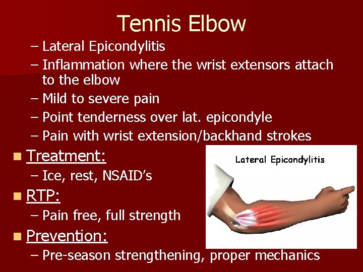 Tennis Elbow – Lateral Epicondylitis – Inflammation where the wrist extensors attach to the