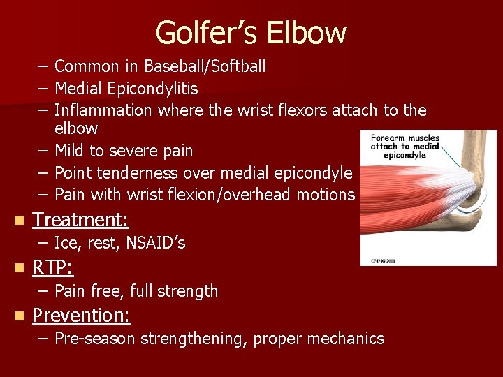 Golfer’s Elbow – – – n Common in Baseball/Softball Medial Epicondylitis Inflammation where the