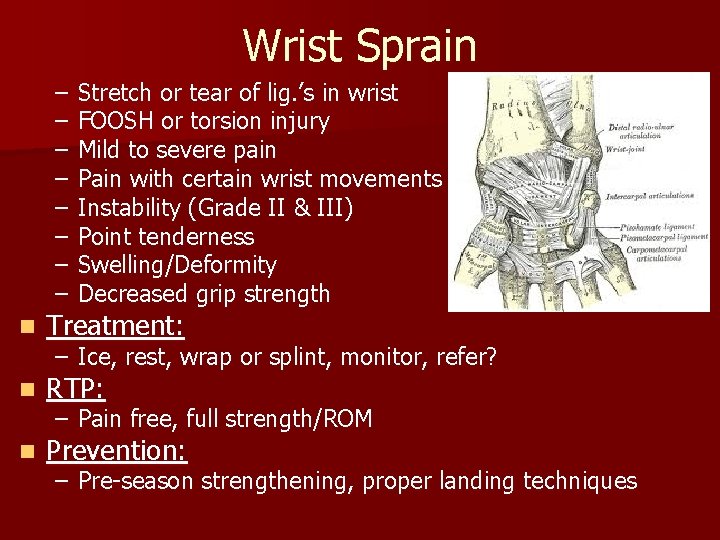Wrist Sprain – – – – Stretch or tear of lig. ’s in wrist