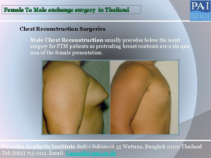 Female To Male exchange surgery in Thailand Chest Reconstruction Surgeries Male Chest Reconstruction usually