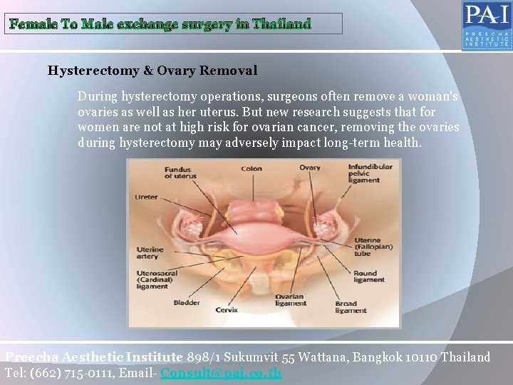 Female To Male exchange surgery in Thailand Hysterectomy & Ovary Removal During hysterectomy operations,