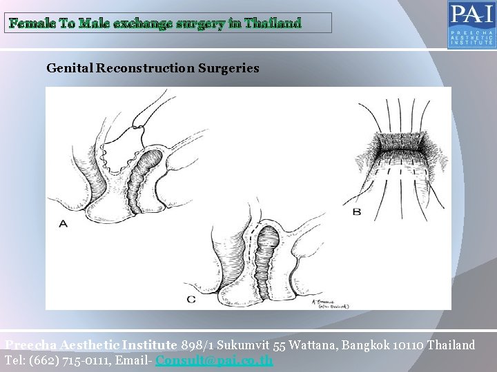 Female To Male exchange surgery in Thailand Genital Reconstruction Surgeries Preecha Aesthetic Institute 898/1