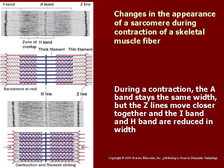 Changes in the appearance of a sarcomere during contraction of a skeletal muscle fiber