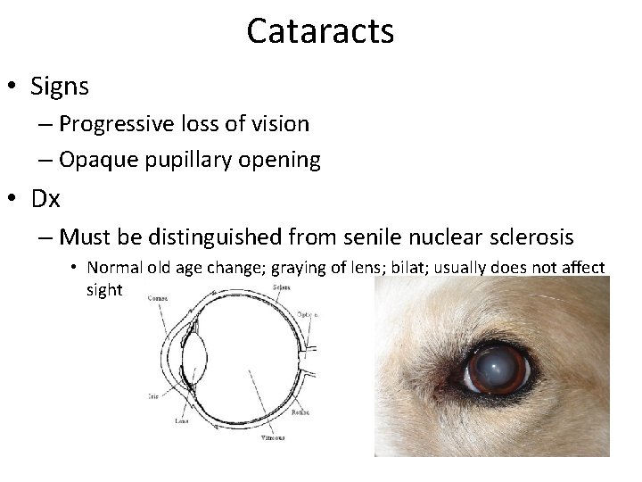 Cataracts • Signs – Progressive loss of vision – Opaque pupillary opening • Dx