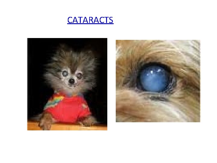 CATARACTS 