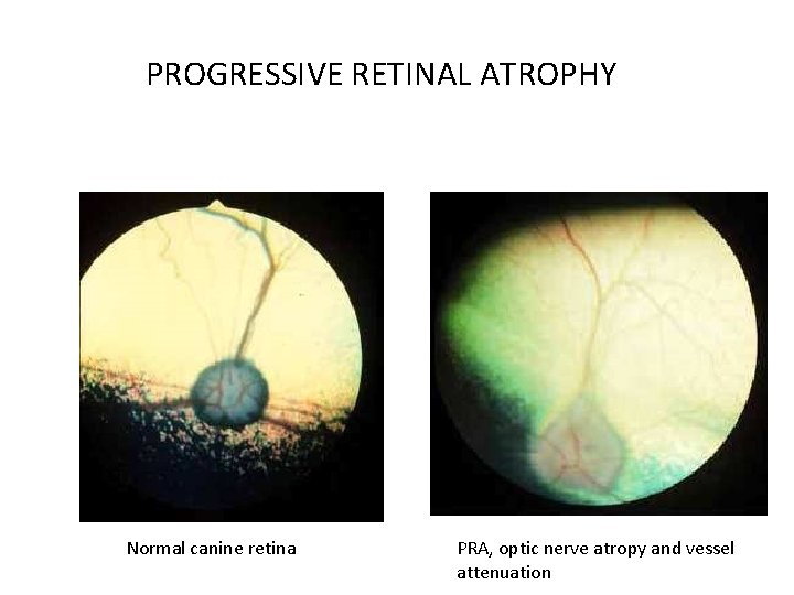 PROGRESSIVE RETINAL ATROPHY Normal canine retina PRA, optic nerve atropy and vessel attenuation 