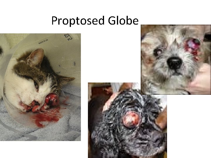 Proptosed Globe 
