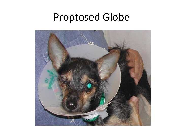 Proptosed Globe 