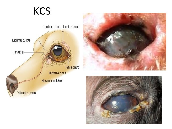 KCS 