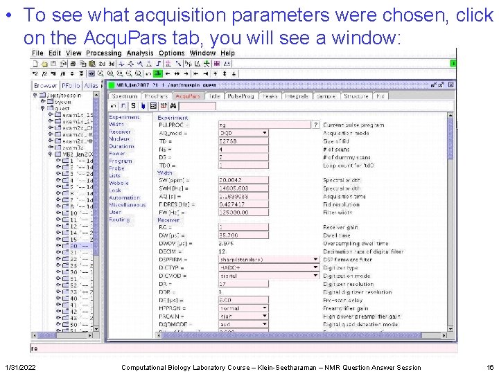  • To see what acquisition parameters were chosen, click on the Acqu. Pars