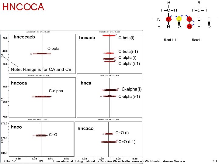 HNCOCA 1/31/2022 Computational Biology Laboratory Course – Klein-Seetharaman – NMR Question Answer Session 36