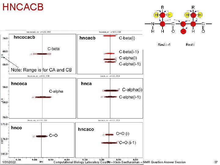 HNCACB 1/31/2022 Computational Biology Laboratory Course – Klein-Seetharaman – NMR Question Answer Session 37