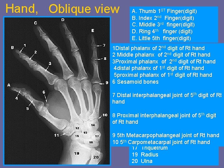 Hand, Oblique view A. Thumb 1 ST Finger(digit) B. Index 2 nd Finger(digit) C.