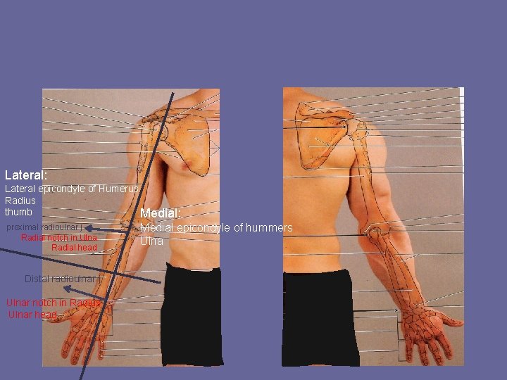 Lateral: Lateral epicondyle of Humerus Radius thumb Medial: proximal radioulnar j Radial notch in