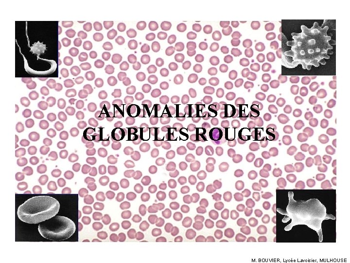 ANOMALIES DES GLOBULES ROUGES M. BOUVIER, Lycée Lavoisier, MULHOUSE 