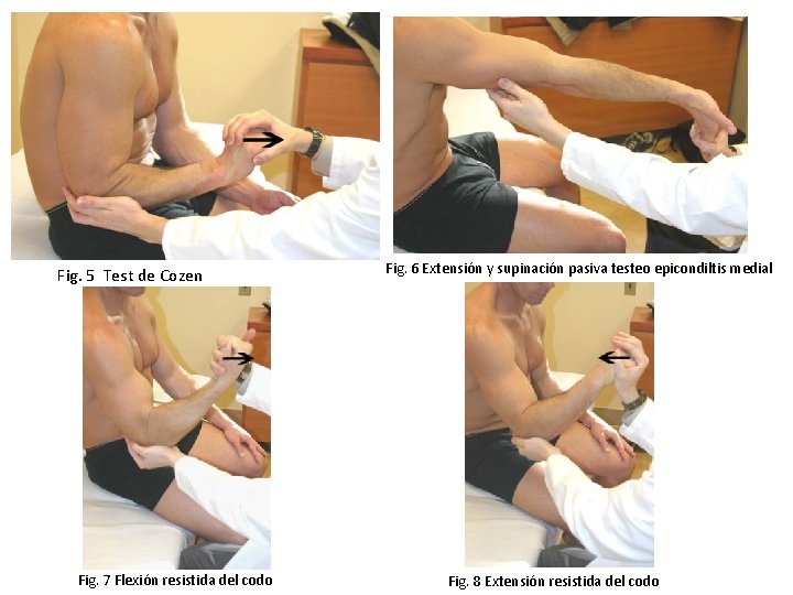 Fig. 5 Test de Cozen Fig. 7 Flexión resistida del codo Fig. 6 Extensión