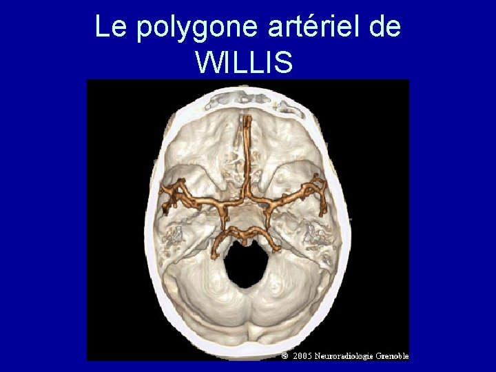 Le polygone artériel de WILLIS 