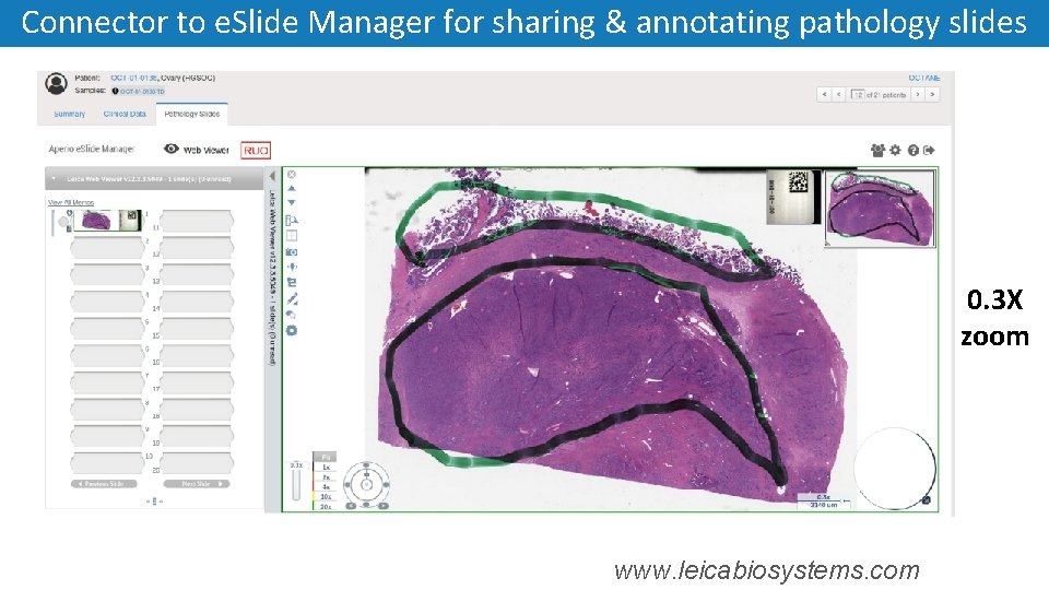 Connector to e. Slide Manager for sharing & annotating pathology slides 0. 3 X