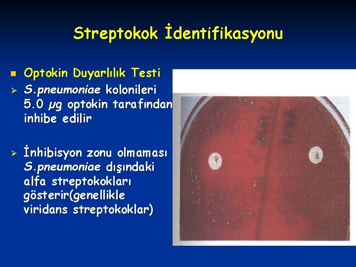 Streptokok İdentifikasyonu n Ø Ø Optokin Duyarlılık Testi S. pneumoniae kolonileri 5. 0 µg