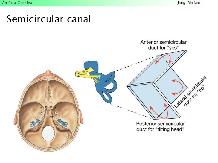 Artificial Cochlea Semicircular canal Jong-Mo Seo 