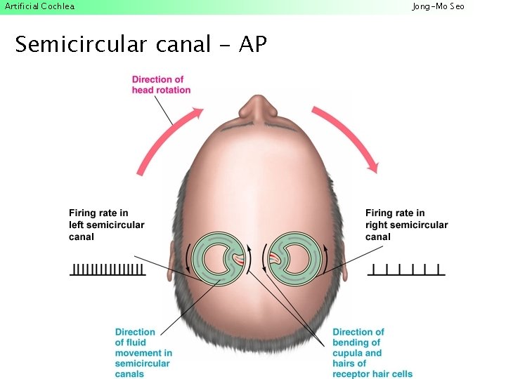 Artificial Cochlea Semicircular canal - AP Jong-Mo Seo 