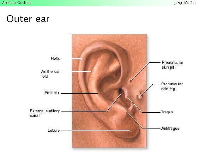 Artificial Cochlea Outer ear Jong-Mo Seo 