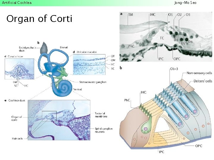 Artificial Cochlea Organ of Corti Jong-Mo Seo 
