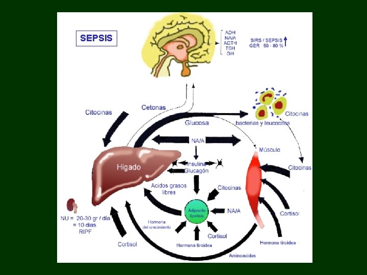 SEPSIS 