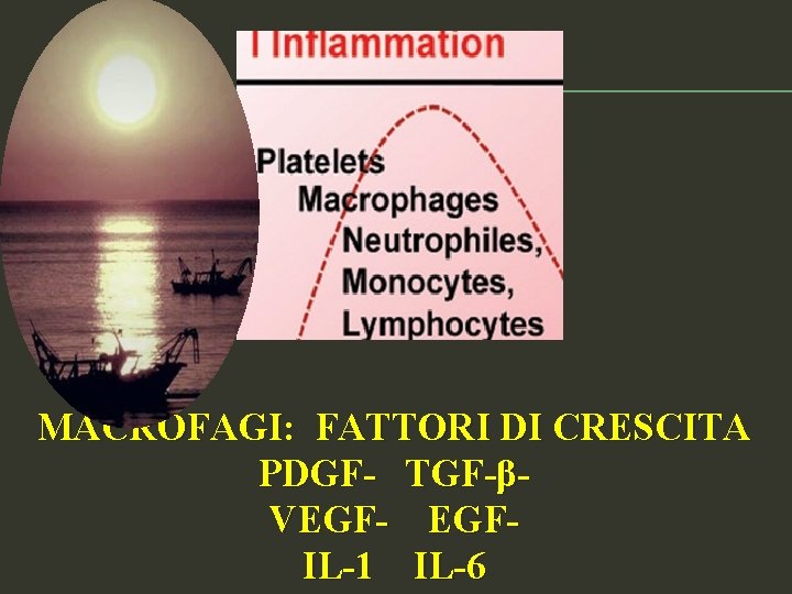 MACROFAGI: FATTORI DI CRESCITA PDGF- TGF-βVEGF- EGFIL-1 IL-6 