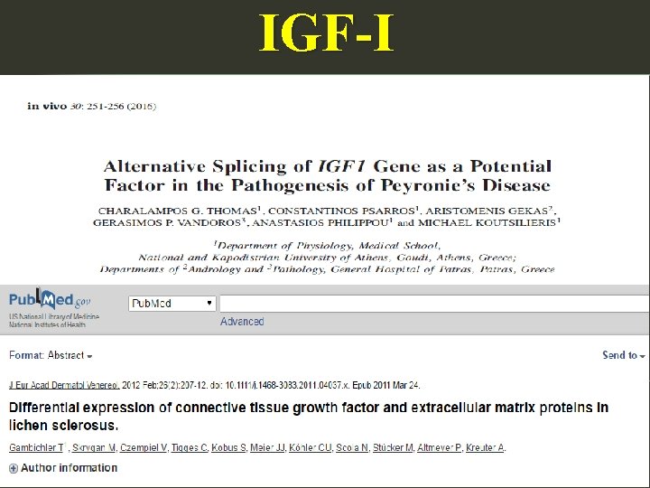 IGF-I 