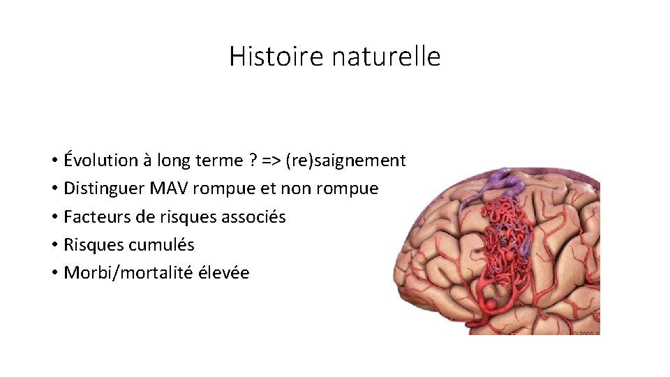 Histoire naturelle • Évolution à long terme ? => (re)saignement • Distinguer MAV rompue